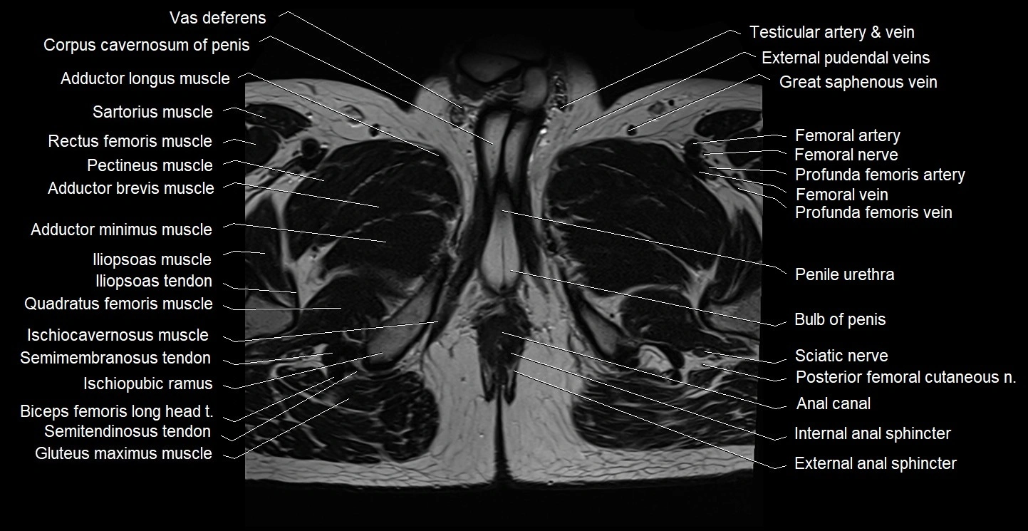 Male pelvis axial cross sectional anatomy image 45.webp